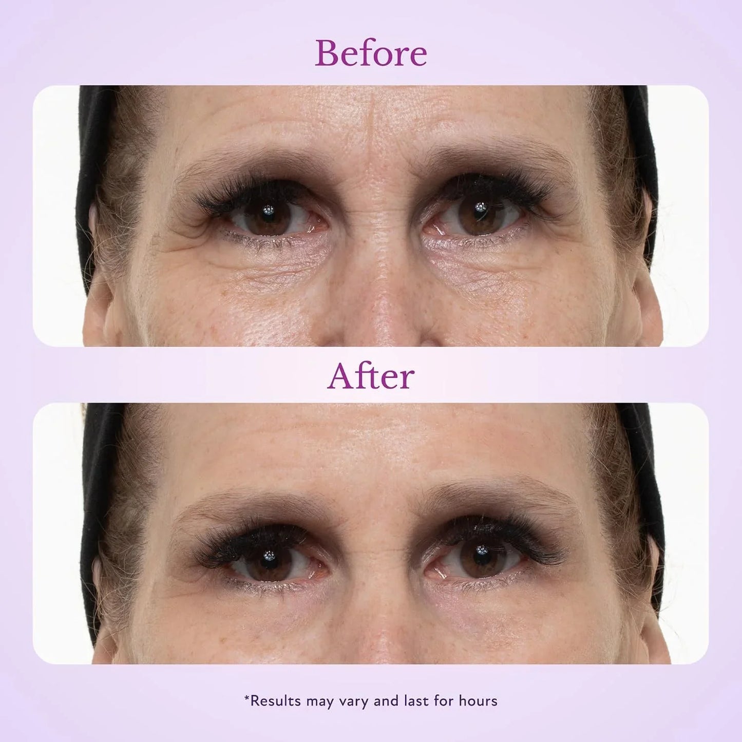Fempick 60 Second Effects Tinted Firming Gel - Under Eye Cream For Puffiness And Bags Under Eyes