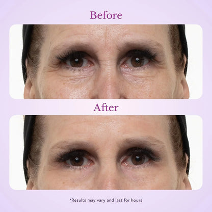 Fempick 60 Second Effects Tinted Firming Gel - Under Eye Cream For Puffiness And Bags Under Eyes