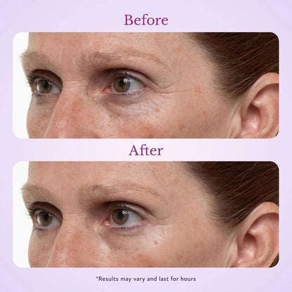 Fempick 60 Second Effects Tinted Firming Gel - Under Eye Cream For Puffiness And Bags Under Eyes